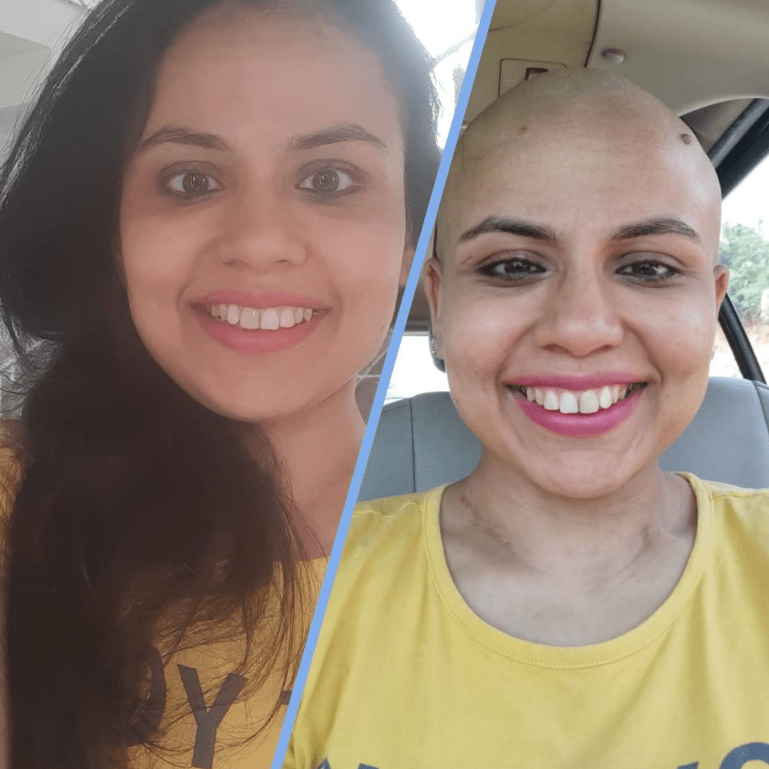 Harsha Nagi smiling bright despite her stage 3 breast cancer diagnosis. Cheers to life!